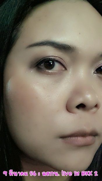 ลสกน กับประสบการณ์เลสิคจ้า
