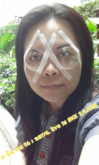 ลสกน กับประสบการณ์เลสิคจ้า