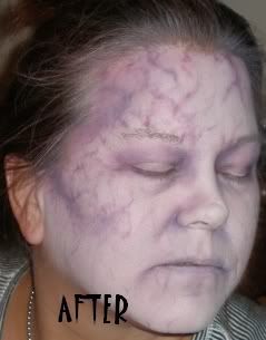 Carolyn after