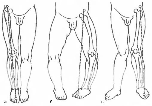 Как измерить длину нижней конечности. Kornilov 01 02. Как измерить длину нижней конечности фото. Как измерить длину нижней конечности-Kornilov 01 02. картинка Как измерить длину нижней конечности. картинка Kornilov 01 02