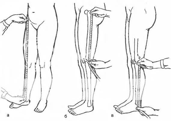 Как измерить длину нижней конечности. Kornilov 01 04. Как измерить длину нижней конечности фото. Как измерить длину нижней конечности-Kornilov 01 04. картинка Как измерить длину нижней конечности. картинка Kornilov 01 04