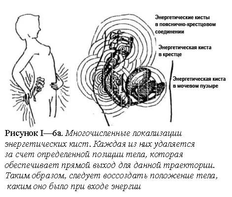 musculus trapezius